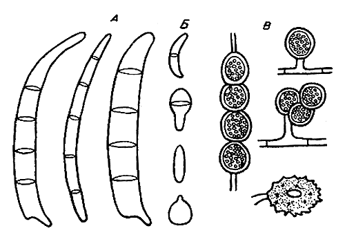 Рис. 3. Плодоношение грибов из рода Fusarium: А — макроконидии; Б — микроконидии; В — хламидоспоры